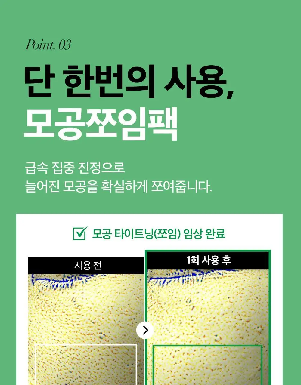 [급속쿨링진정 / 모공쪼임] 오어스 쿨 시카 티트리 모델링 팩 풀패키지 상세페이지 25